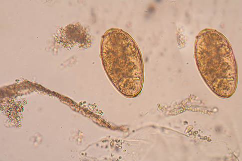 Schisto pathogen